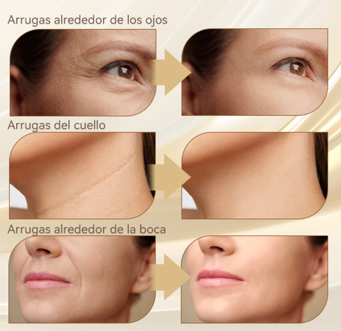 Kneck®️ Masajeador Facial Eléctrico Antiarrugas