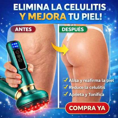 CelluLuxe™ | Reduce la apariencia de la celulitis para que no vuelvas a esconder tu piel!
